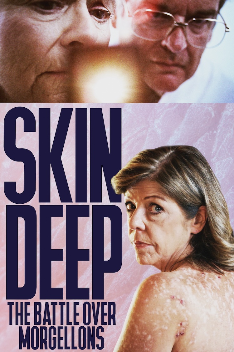 SKIN DEEP Poster